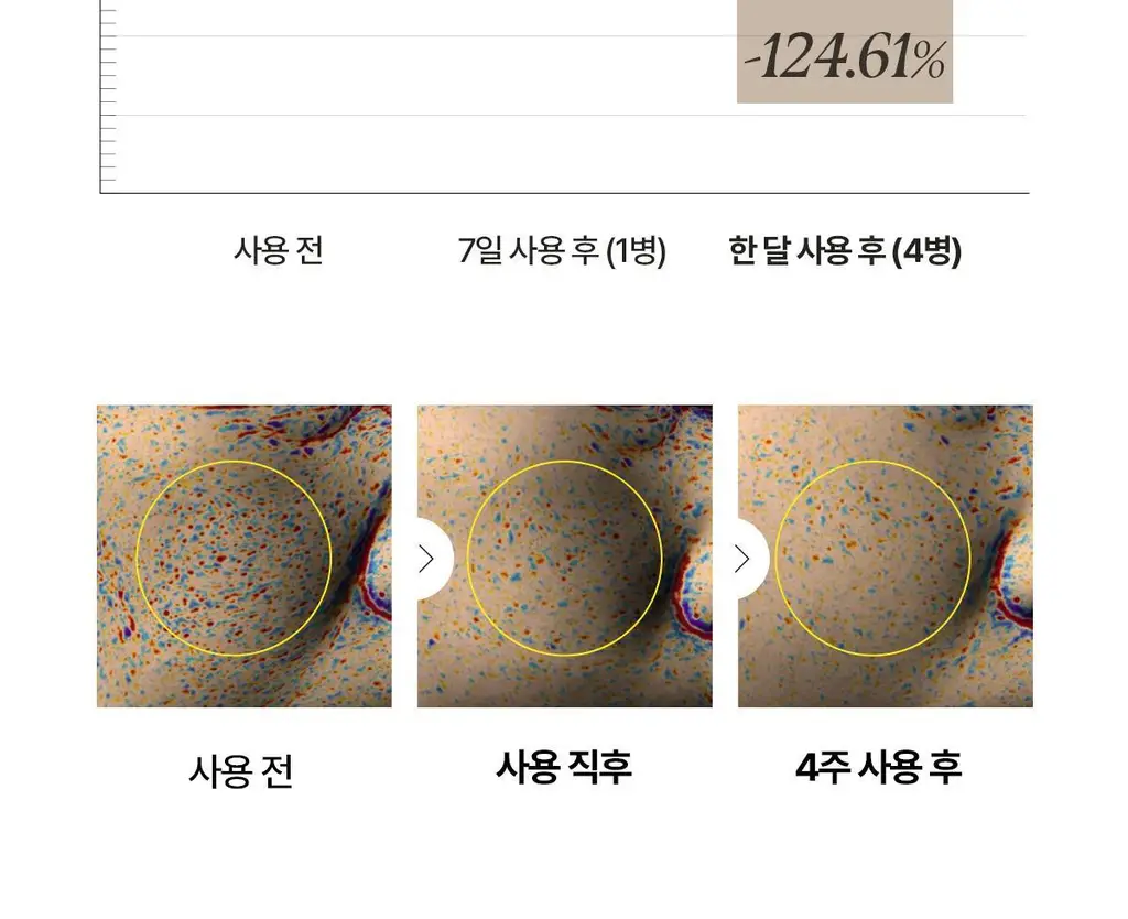 [1+1 NMN 급속모공앰플] 아떼 포어셀 프로그래밍 앰플 듀오 기획 상세페이지 36